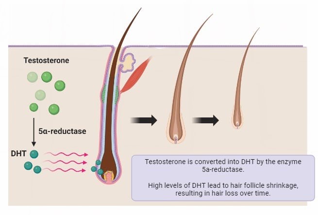 Prevent Hair Thinning